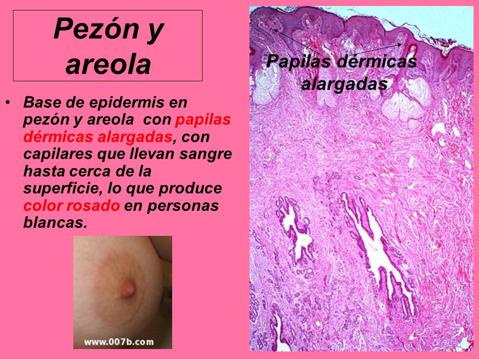En el pezon sangre